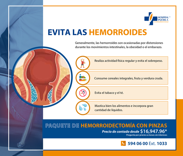 Paquete de Hemorroidectomía con Bisturí Armónico